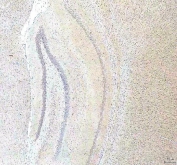 IHC staining of FFPE rat brain tissue with PCMT1 antibody. HIER: boil tissue sections in pH8 EDTA for 20 min and allow to cool before testing.