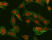 Immunofluorescent staining of FFPE human A549 cells with Interferon regulatory factor 4 antibody (red) and Phalloidin-iFluor 488 (green). HIER: steam section in pH6 citrate buffer for 20 min.