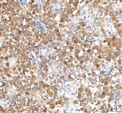IHC staining of FFPE human testicular seminoma tissue with ISYNA1 antibody. HIER: boil tissue sections in pH8 EDTA for 20 min and allow to cool before testing.