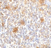 IHC staining of FFPE human testicular seminoma tissue with MFSD12 antibody. HIER: boil tissue sections in pH8 EDTA for 20 min and allow to cool before testing.