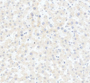 IHC staining of FFPE human liver tissue with HSD3B7 antibody, HRP-secondary and DAB substrate. HIER: boil tissue sections in pH8 EDTA for 20 min and allow to cool before testing.