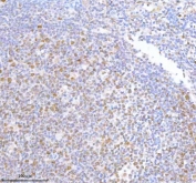 IHC staining of FFPE human tonsil tissue with METTL18 antibody. HIER: boil tissue sections in pH8 EDTA for 20 min and allow to cool before testing.