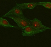 Immunofluorescent staining of FFPE human U-2OS cells with METTL18 antibody (red) and Beta Tubulin mAb (green). HIER: steam section in pH6 citrate buffer for 20 min.