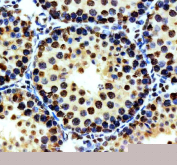 IHC staining of FFPE mouse testis tissue with Phospho-MDM2 antibody, HRP-secondary and DAB substrate. HIER: boil tissue sections in pH8 EDTA for 20 min and allow to cool before testing.