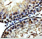 IHC staining of FFPE rat testis tissue with Phospho-MDM2 antibody, HRP-secondary and DAB substrate. HIER: boil tissue sections in pH8 EDTA for 20 min and allow to cool before testing.