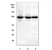 Western blot testing of human 1) 293T, 2) U-251 and 3) Jurkat cell lysate with ST15 antibody. Predicted molecular weight ~106 kDa.