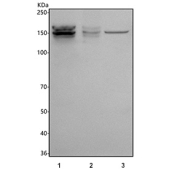Western blot testing of human 1) Caco-2, 2) SiHa and 3) HeLa cell lysate with Intersectin 1 antibody. Predicted molecular weight: 105-195 kDa (multiple isoforms).