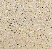 IHC staining of FFPE human brain tissue with Intersectin 1 antibody, HRP-secondary and DAB substrate. HIER: boil tissue sections in pH8 EDTA for 20 min and allow to cool before testing.