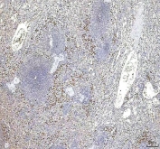 IHC staining of FFPE human spleen tissue with S100A12 antibody. HIER: boil tissue sections in pH8 EDTA for 20 min and allow to cool before testing.