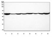 Western blot testing of human 1) COLO-320, 2) HL60, 3) HeLa, 4) MCF7, 5) SH-SY5Y, 6) ThP-1, 7) U-251 and 8) PC-3 cell lysate with CALR antibody. Predicted molecular weight ~48 kDa but routinely observed at 55~60 kDa.