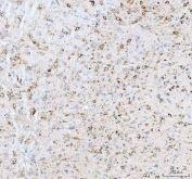 IHC staining of FFPE mouse brain tissue with CALR antibody. HIER: boil tissue sections in pH8 EDTA for 20 min and allow to cool before testing.