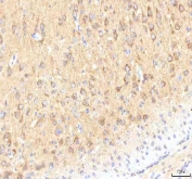 IHC staining of FFPE rat brain tissue with CALR antibody. HIER: boil tissue sections in pH8 EDTA for 20 min and allow to cool before testing.