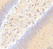 IHC staining of FFPE rat brain tissue with CALR antibody. HIER: boil tissue sections in pH8 EDTA for 20 min and allow to cool before testing.