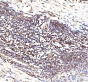 IHC staining of FFPE human tonsil tissue with CALR antibody. HIER: boil tissue sections in pH8 EDTA for 20 min and allow to cool before testing.