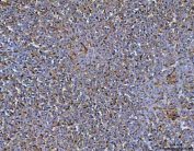 IHC staining of FFPE rat liver tissue with MRC1 antibody. HIER: boil tissue sections in pH8 EDTA for 20 min and allow to cool before testing.