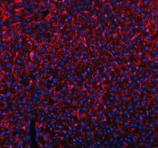 Immunofluorescent staining of FFPE mouse liver tissue with MRC1 antibody (red) and DAPI nuclear stain (blue). HIER: steam section in pH8 EDTA buffer for 20 min.