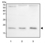 Western blot testing of human 1) Jurkat, 2) HeLa and 3) Caco-2 cell lysate with NUDT15 antibody. Predicted molecular weight ~19 kDa.