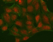 Immunofluorescent staining of FFPE human A549 cells with NUDT15 antibody (red) and Phalloidin-iFluor 488 conjugate (green). HIER: steam section in pH6 citrate buffer for 20 min.