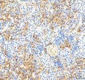 IHC staining of FFPE mouse kidney tissue with Pyridoxal kinase antibody. HIER: boil tissue sections in pH8 EDTA for 20 min and allow to cool before testing.