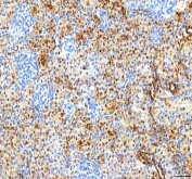 IHC staining of FFPE rat kidney tissue with Pyridoxal kinase antibody. HIER: boil tissue sections in pH8 EDTA for 20 min and allow to cool before testing.