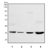 Western blot testing of human 1) HeLa, 2) 293T, 3) A549 and 4) SiHa cell lysate with Pyridoxal kinase antibody. Predicted molecular weight ~35 kDa.