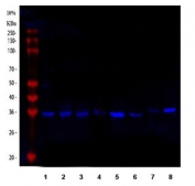 Western blot testing of 1) human HeLa, 2) human RT4, 3) human A549, 4) rat kidney, 5) rat brain, 6) mouse brain and 7) mouse kidney tissue lysate with Pyridoxal kinase antibody. Predicted molecular weight ~35 kDa.