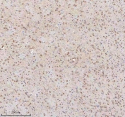 IHC staining of FFPE rat brain tissue (midbrain) with U1-70K antibody. HIER: boil tissue sections in pH8 EDTA for 20 min and allow to cool before testing.