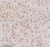 IHC staining of FFPE rat brain tissue (midbrain) with U1-70K antibody. HIER: boil tissue sections in pH8 EDTA for 20 min and allow to cool before testing.