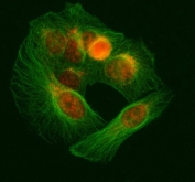 Immunofluorescent staining of FFPE human U-2 OS cells with U1-70K antibody (red) and Beta Tubulin mAb (green). HIER: steam section in pH6 citrate buffer for 20 min.