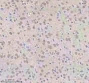 IHC staining of FFPE rat brain tissue (cerebral cortex) with U1-70K antibody. HIER: boil tissue sections in pH8 EDTA for 20 min and allow to cool before testing.