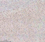IHC staining of FFPE rat brain tissue (cerebral cortex) with U1-70K antibody. HIER: boil tissue sections in pH8 EDTA for 20 min and allow to cool before testing.