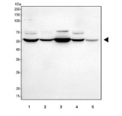 Western blot testing of 1) human HeLa, 2) human Jurkat, 3) human HepG2, 4) human 293T and 4) rat brain tissue lysate with U1-70K antibody. Predicted molecular weight ~52 kDa.