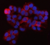 Immunofluorescent staining of FFPE human T-47 D cells with GlnRS antibody (red) and DAPI nuclear stain (blue). HIER: steam section in pH6 citrate buffer for 20 min.