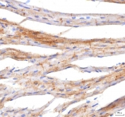 IHC staining of FFPE mouse cardiac tissue with Plakophilin 2 antibody. HIER: boil tissue sections in pH8 EDTA for 20 min and allow to cool before testing.