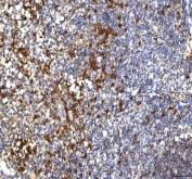 IHC staining of FFPE human tonsil tissue with PCPE1 antibody. HIER: boil tissue sections in pH8 EDTA for 20 min and allow to cool before testing.