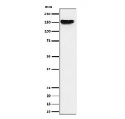 Western blot testing of human Jurkat cell lysate with VGL antibody. Predicted molecular weight ~141 kDa.