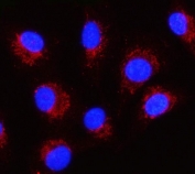 Immunofluorescent staining of FFPE human A549 cells with Serpin B8 antibody (red) and DAPI nuclear stain (blue). HIER: steam section in pH6 citrate buffer for 20 min.