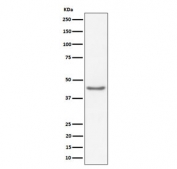 Western blot testing of human HeLa cell lysate with RBMXL2 antibody. Predicted molecular weight ~43 kDa.