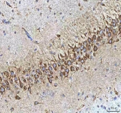 IHC staining of FFPE rat brain tissue with HCRT antibody. HIER: boil tissue sections in pH8 EDTA for 20 min and allow to cool before testing.