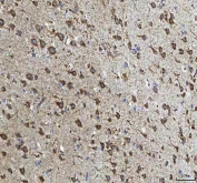 IHC staining of FFPE rat brain tissue with HCRT antibody. HIER: boil tissue sections in pH8 EDTA for 20 min and allow to cool before testing.