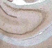 IHC staining of FFPE rat brain tissue with HCRT antibody. HIER: boil tissue sections in pH8 EDTA for 20 min and allow to cool before testing.