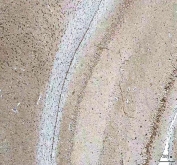 IHC staining of FFPE rat brain tissue with HCRT antibody. HIER: boil tissue sections in pH8 EDTA for 20 min and allow to cool before testing.