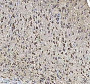 IHC staining of FFPE mouse brain tissue with HCRT antibody. HIER: boil tissue sections in pH8 EDTA for 20 min and allow to cool before testing.