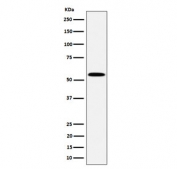 Western blot testing of human Jurkat cell lysate with PNKP antibody. Predicted molecular weight ~57 kDa.