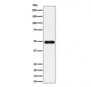 Western blot testing of human K562 cell lysate with NgR3 antibody. Predicted molecular weight ~49 kDa.