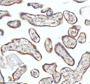 IHC staining of FFPE human placental tissue with MIPEP antibody. HIER: boil tissue sections in pH8 EDTA for 20 min and allow to cool before testing.