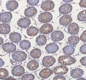 IHC staining of FFPE rat testis tissue with MIPEP antibody. HIER: boil tissue sections in pH8 EDTA for 20 min and allow to cool before testing.