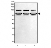 Western blot testing of human 1) HepG2, 2) MCF7 and 3) Caco-2 cell lysate with MIPEP antibody. Predicted molecular weight ~81 kDa, commonly observed at 70-81 kDa.