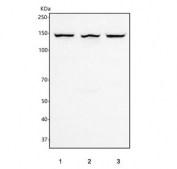 Western blot testing of human 1) HeLa, 2) HepG2 and 3) 293T cell lysate with PIK3R4 antibody. Predicted molecular weight ~153 kDa.