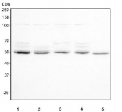 Western blot testing of 1) human HepG2, 2) human 293T, 3) human HeLa, 4) human MCF7 and 5) rat liver tissue lysate with PI4K2B antibody. Predicted molecular weight ~55 kDa.